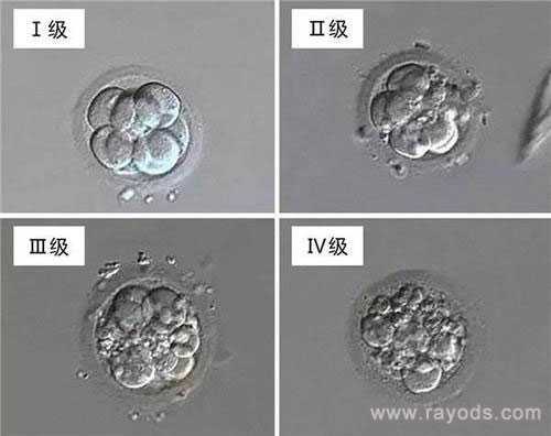 龙岩爱丁助孕_试管婴儿如何选择优质胚胎？原来是胚胎有等级制度