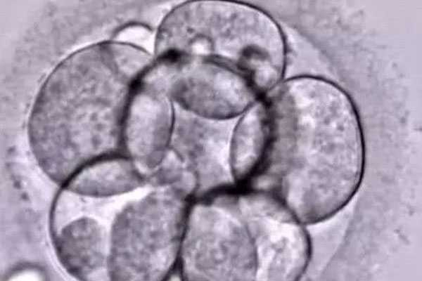 龙岩爱丁助孕_试管婴儿如何选择优质胚胎？原来是胚胎有等级制度