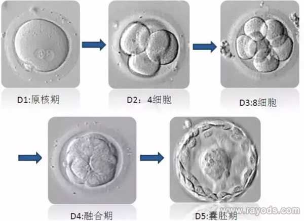 常德AA69助孕地址_试管胚胎等级分类，二级胚胎是不是优质胚胎？