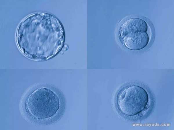 新乡传承助孕中心什么意思_关于试管婴儿养囊胚的那些事，养囊虽好，但并非